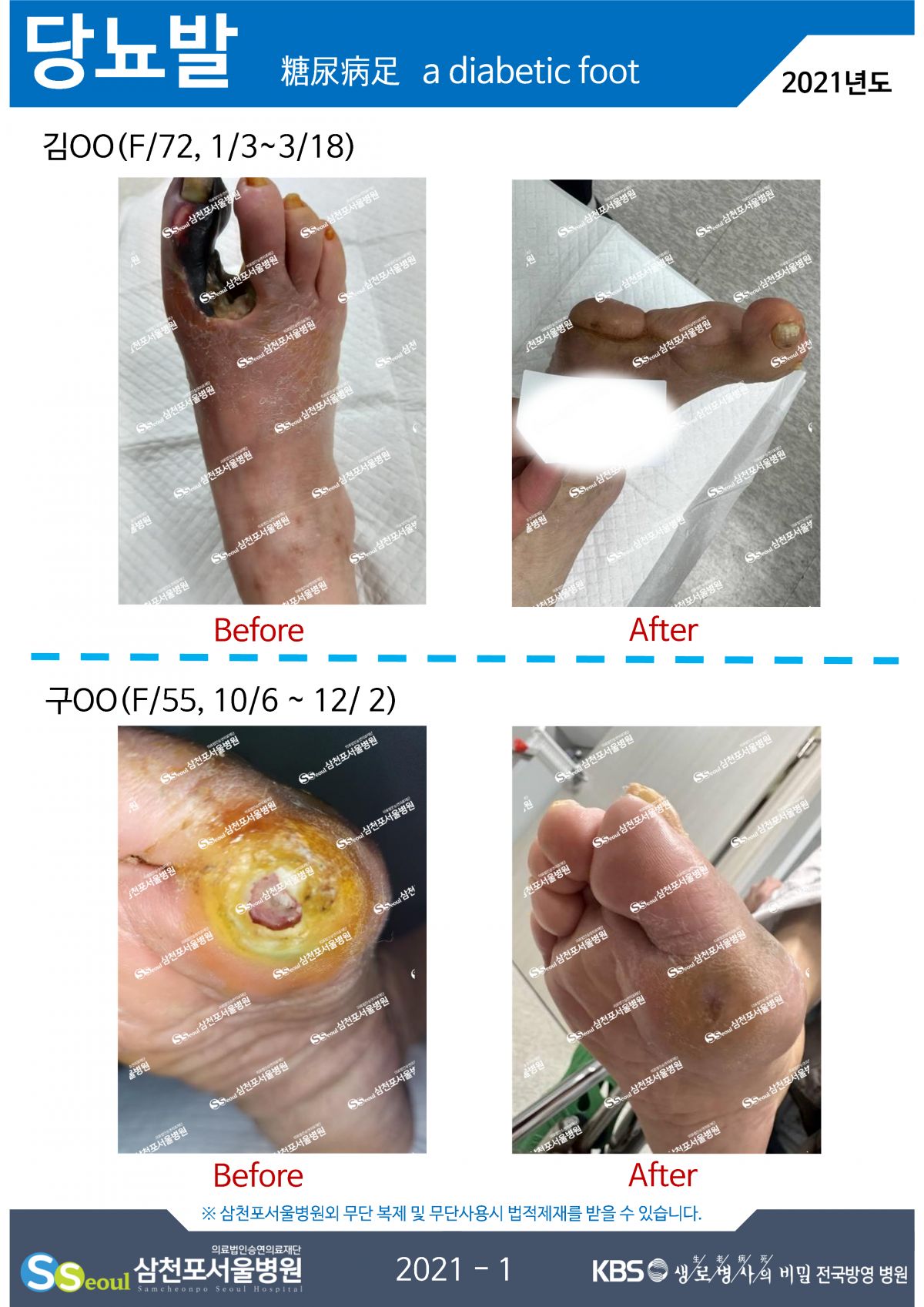 첨부이미지