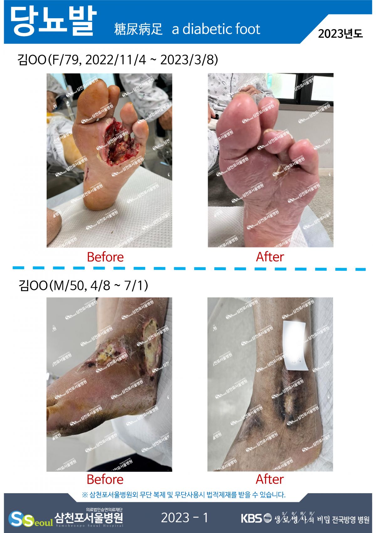 첨부이미지