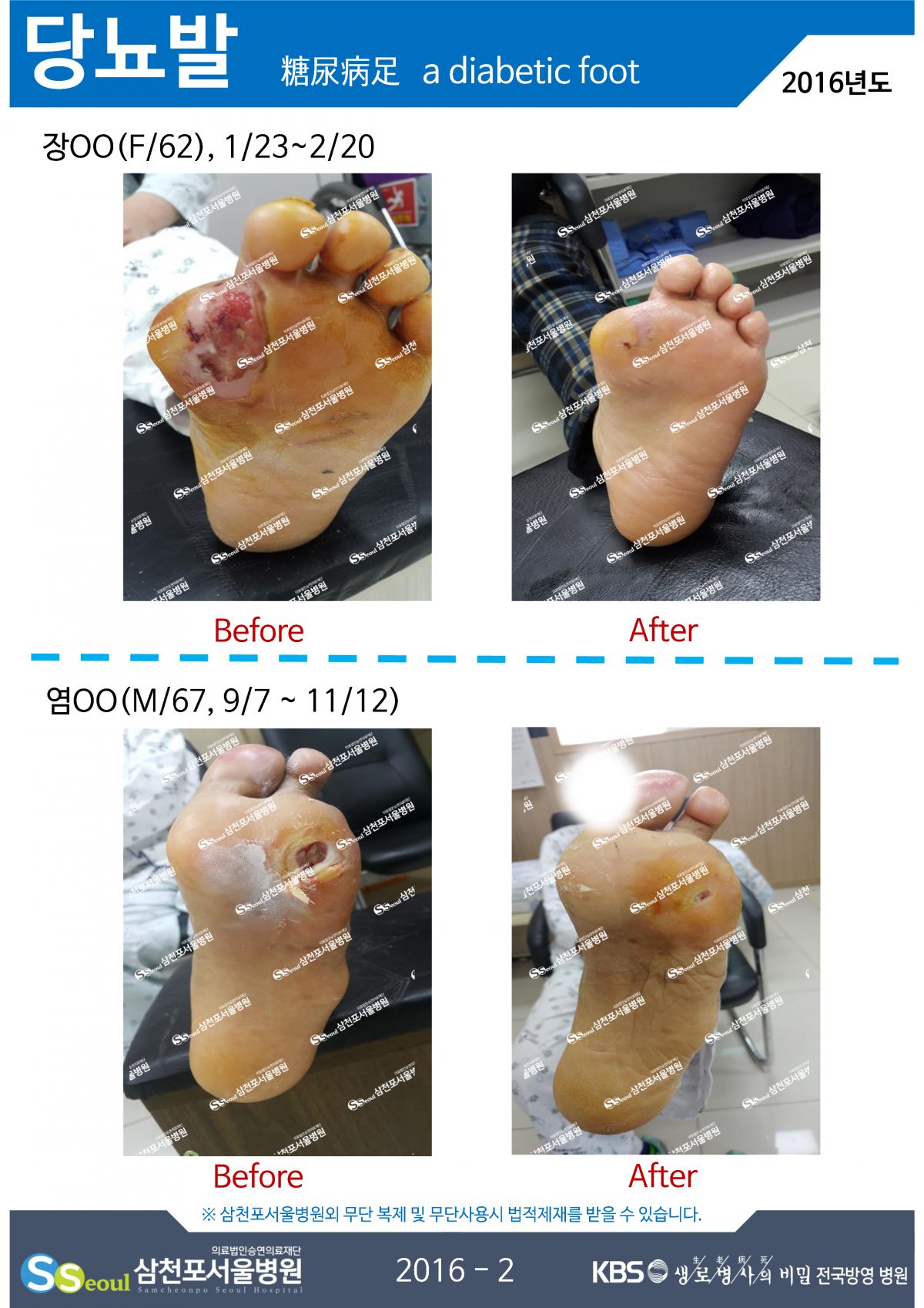 첨부이미지
