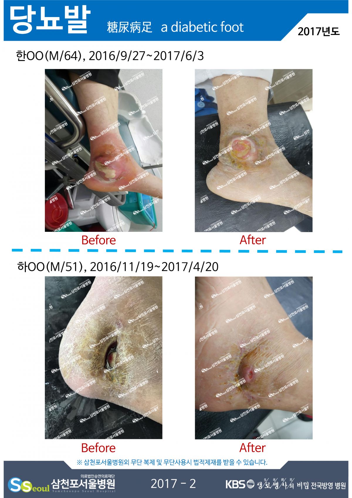 첨부이미지