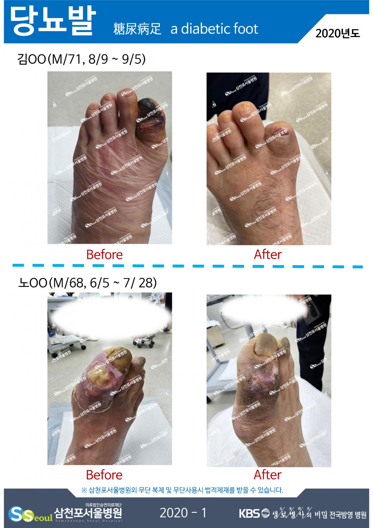 첨부이미지