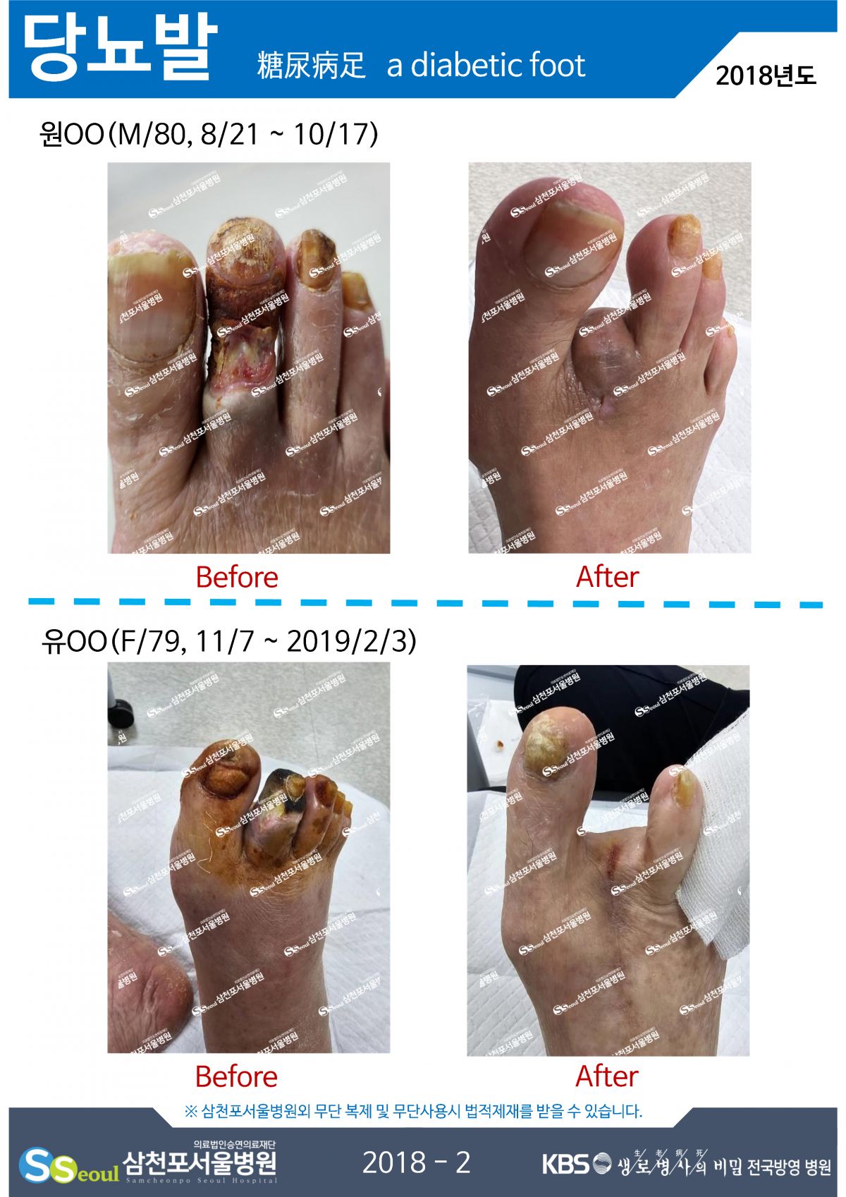 첨부이미지