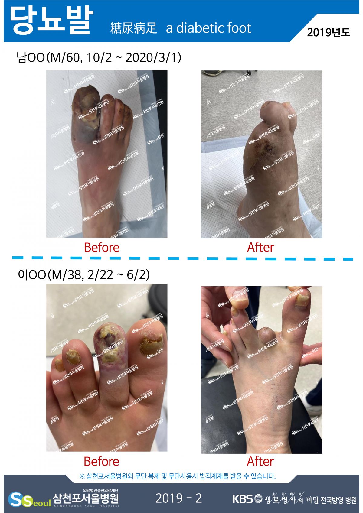 첨부이미지