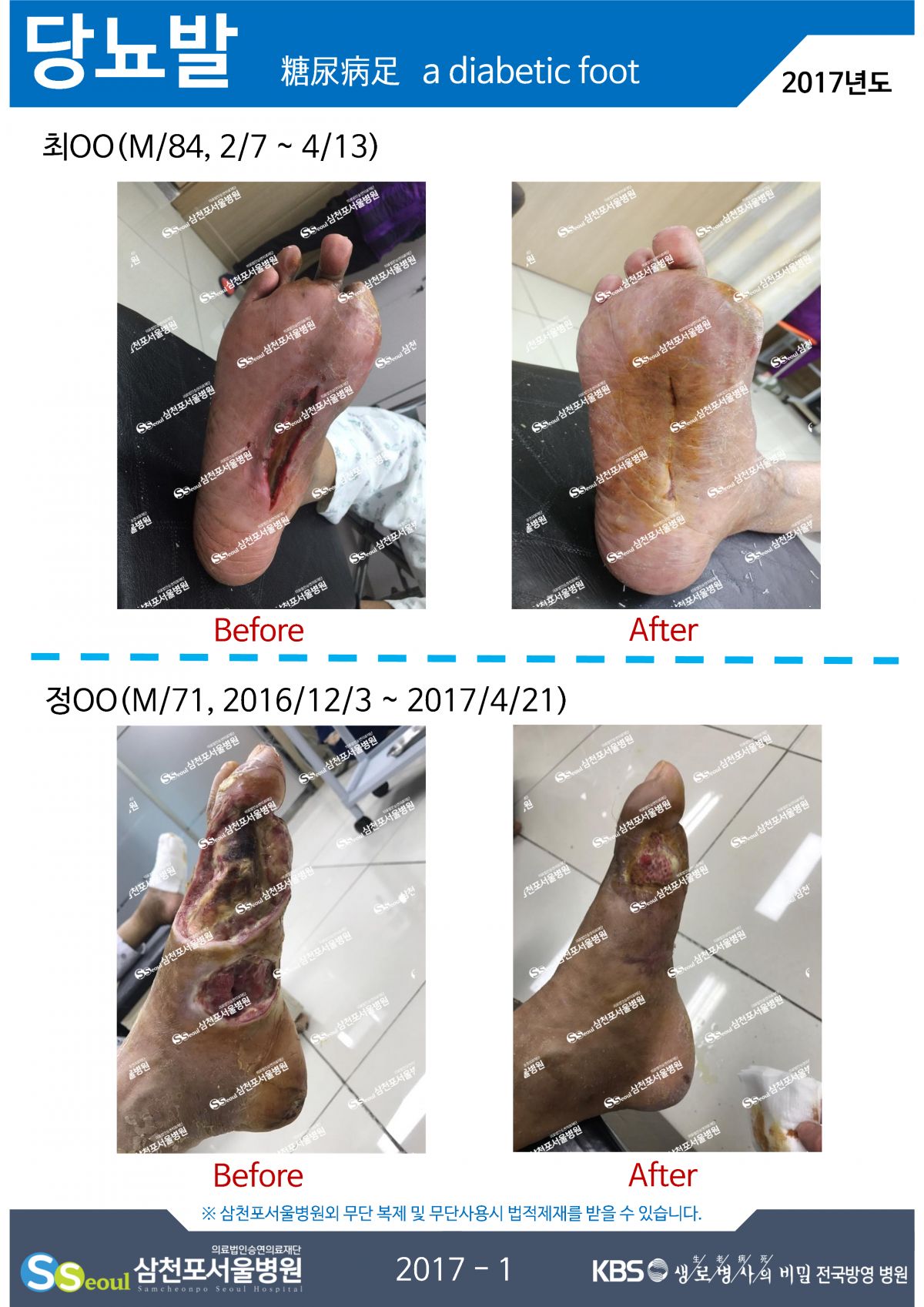 첨부이미지