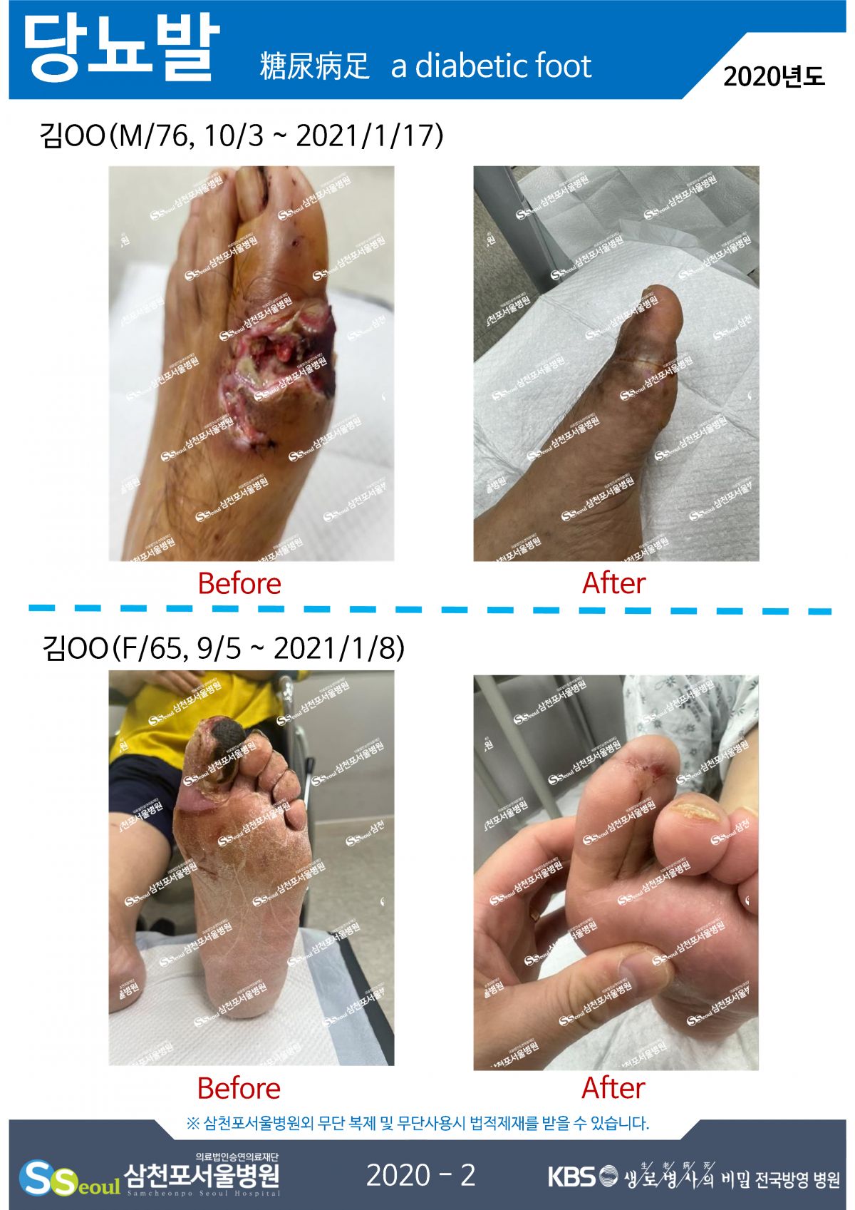 첨부이미지