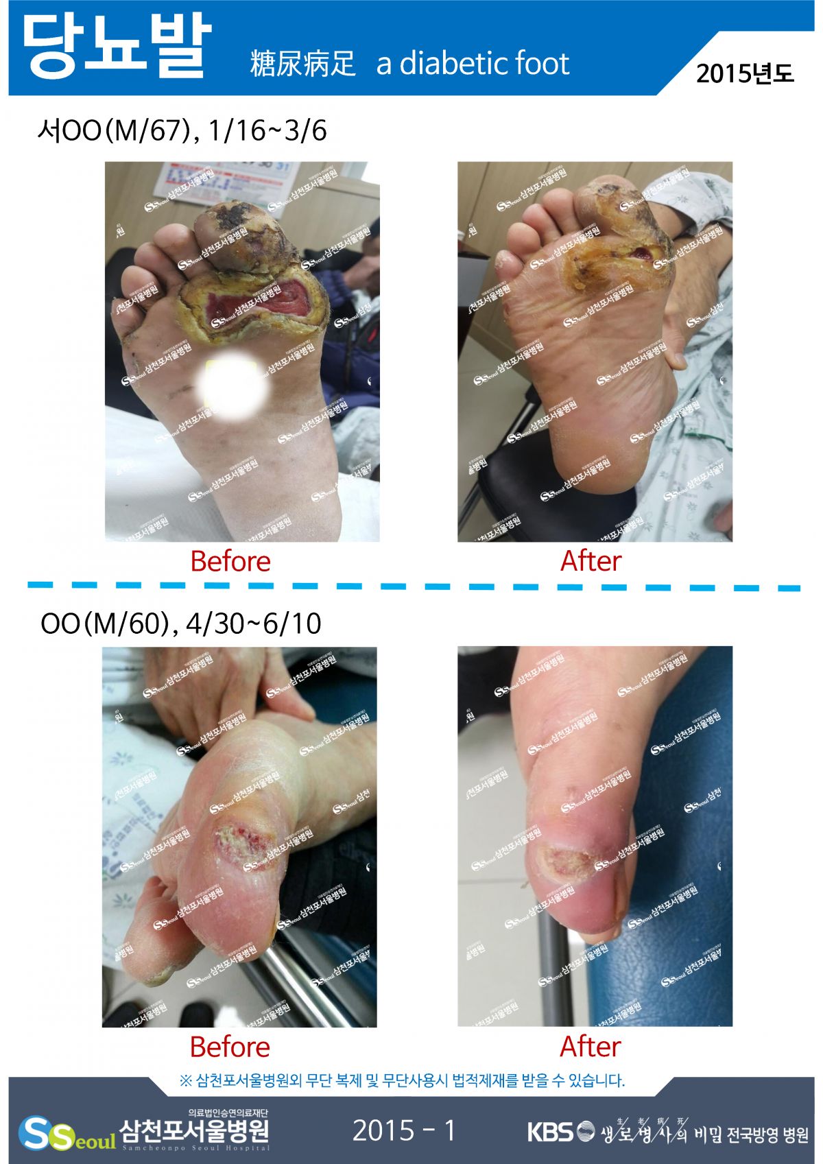 첨부이미지