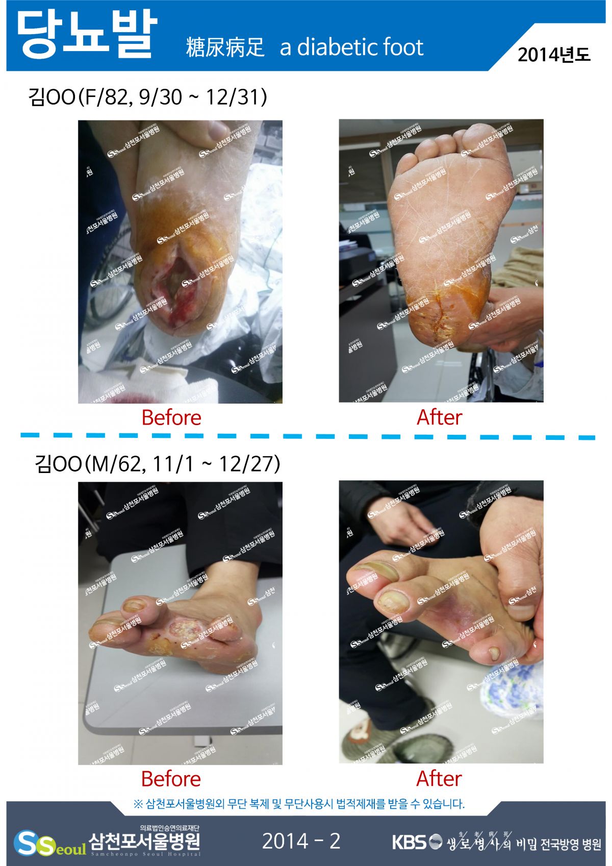 첨부이미지