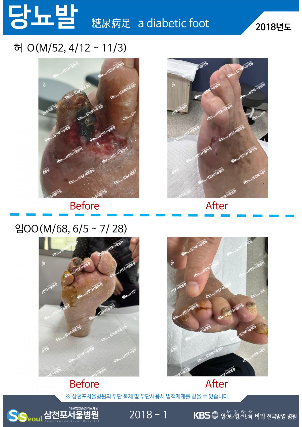 첨부이미지