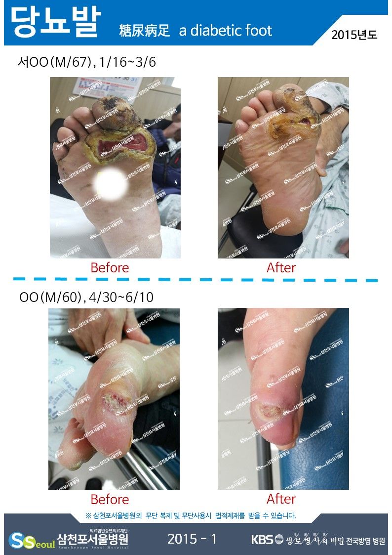 첨부이미지