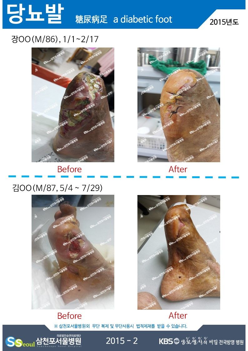 첨부이미지