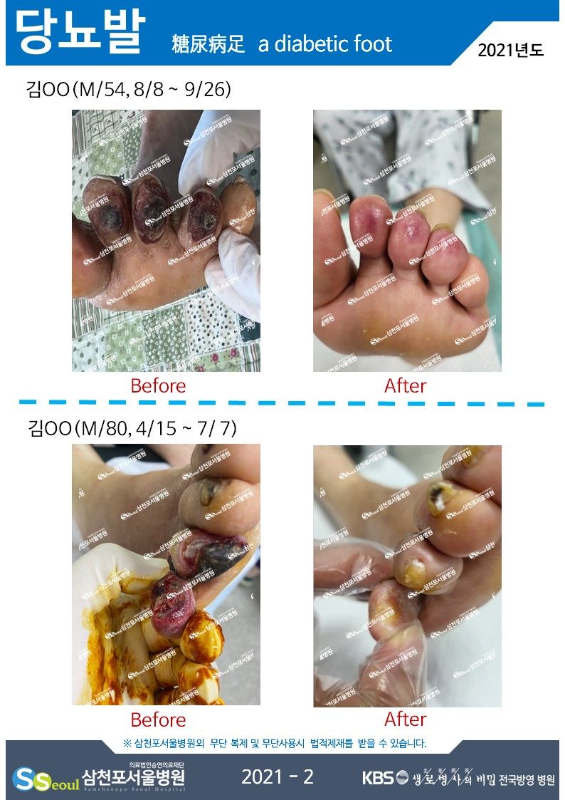 첨부이미지