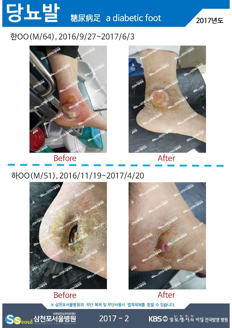 첨부이미지