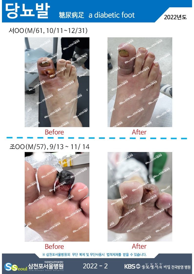 첨부이미지