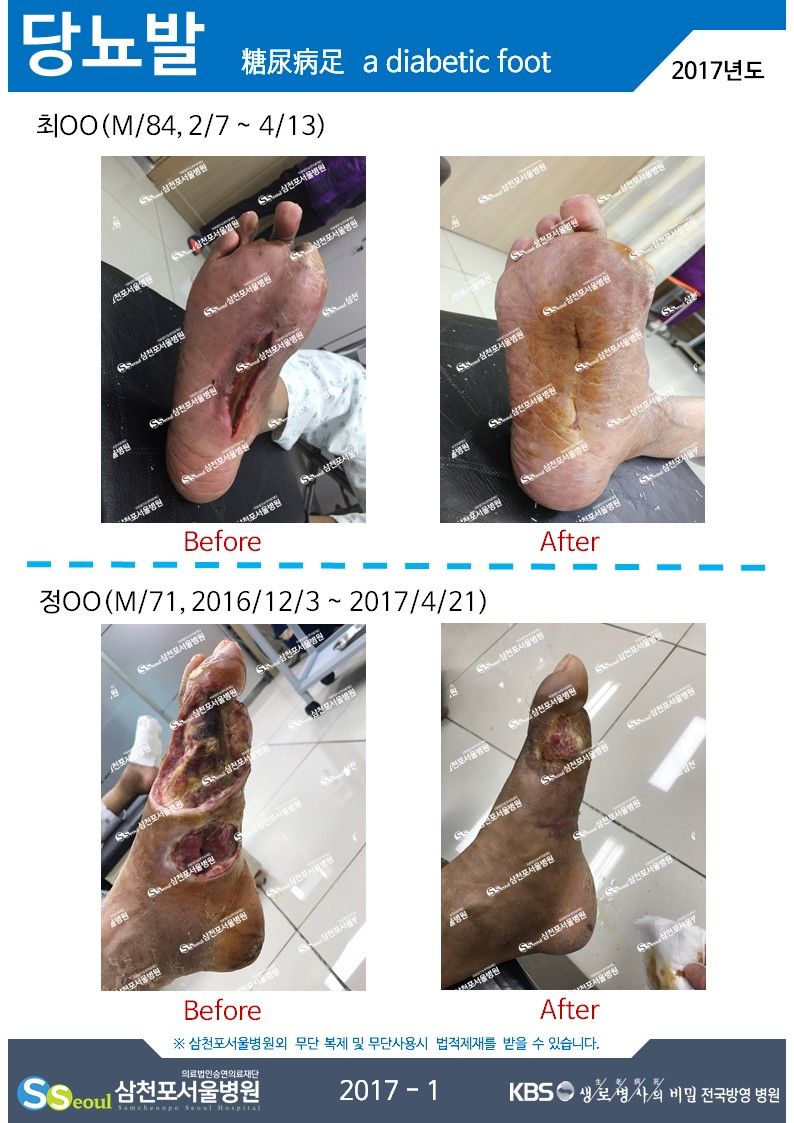 첨부이미지