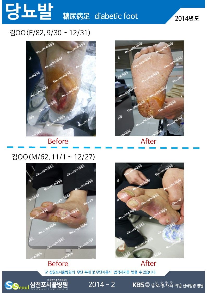 첨부이미지