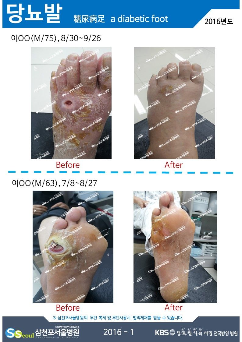 첨부이미지