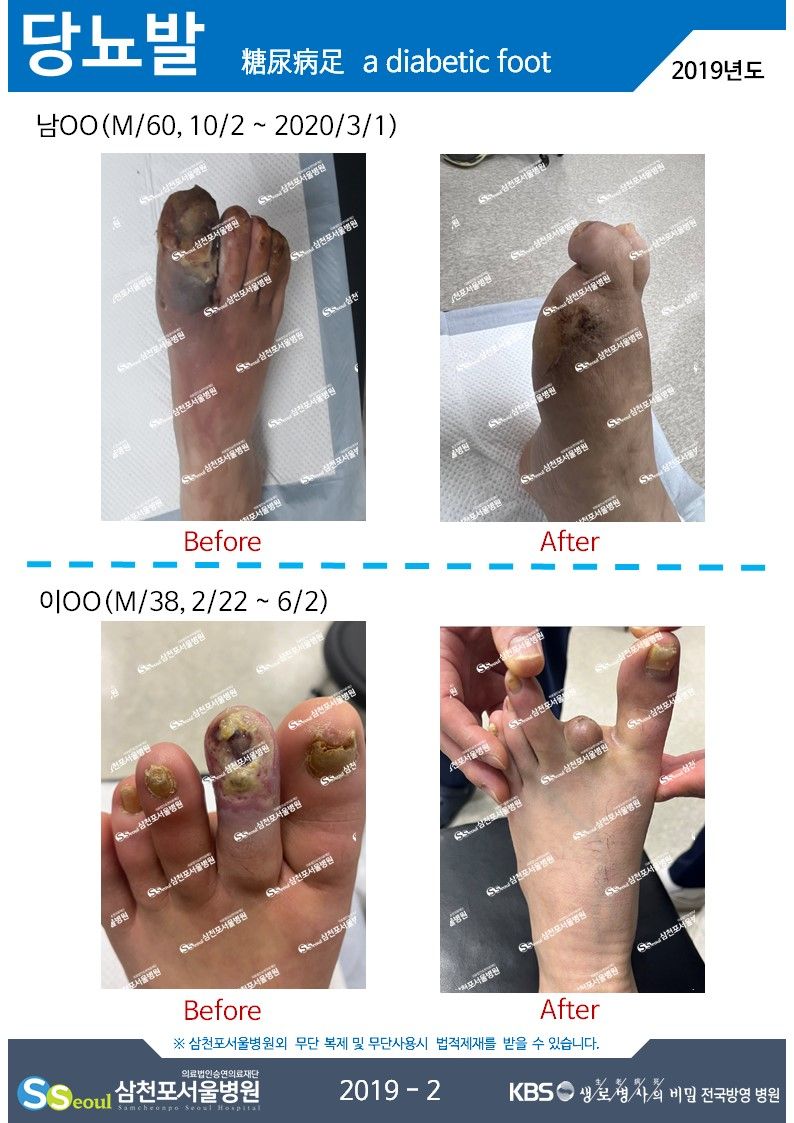 첨부이미지