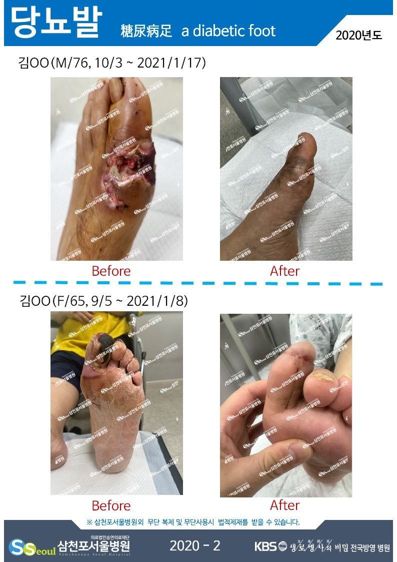 첨부이미지