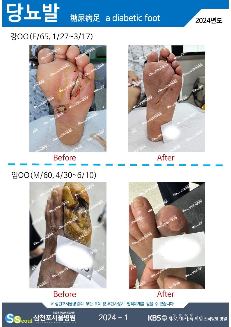 첨부이미지