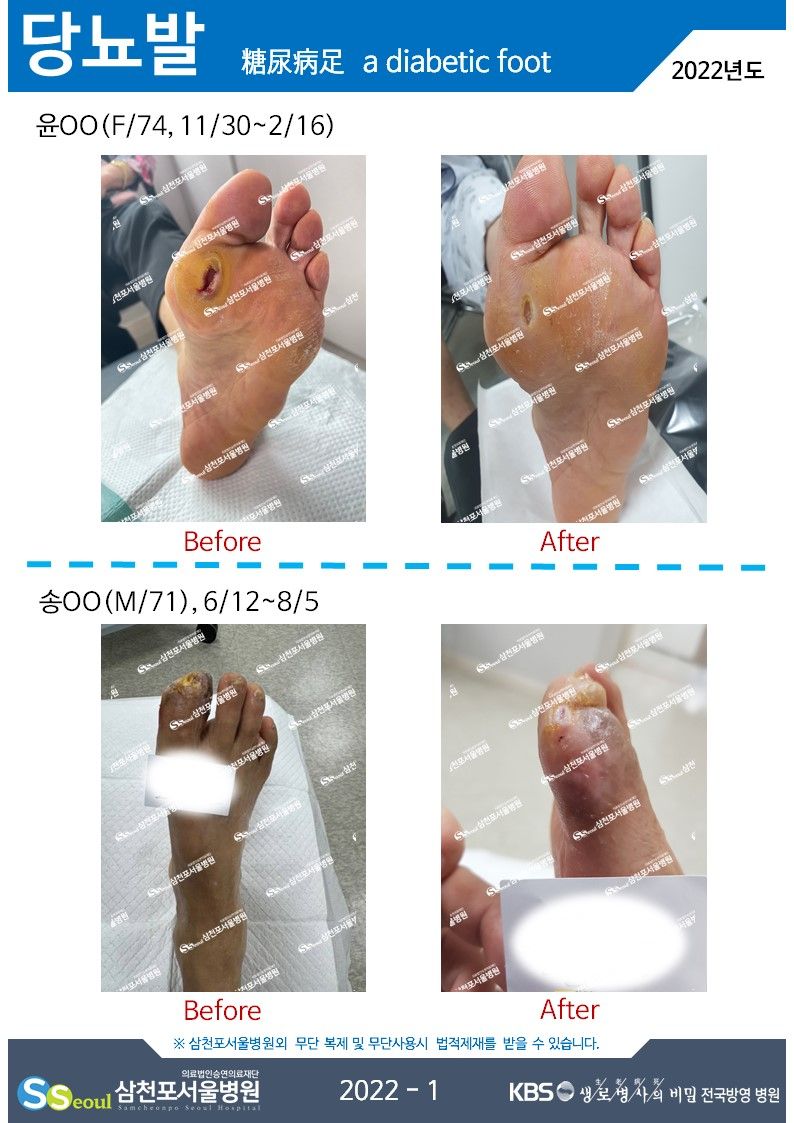 첨부이미지