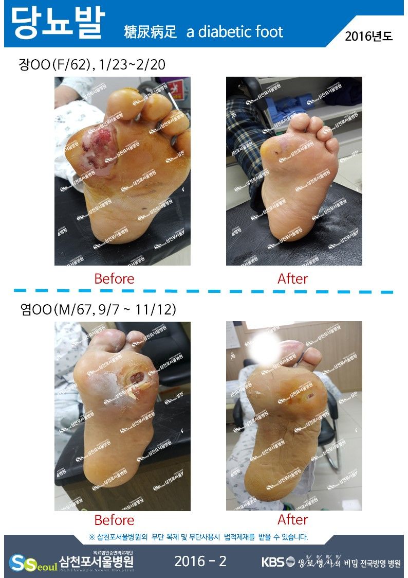 첨부이미지