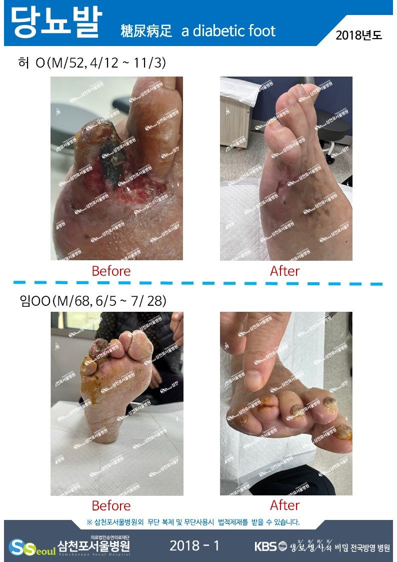 첨부이미지