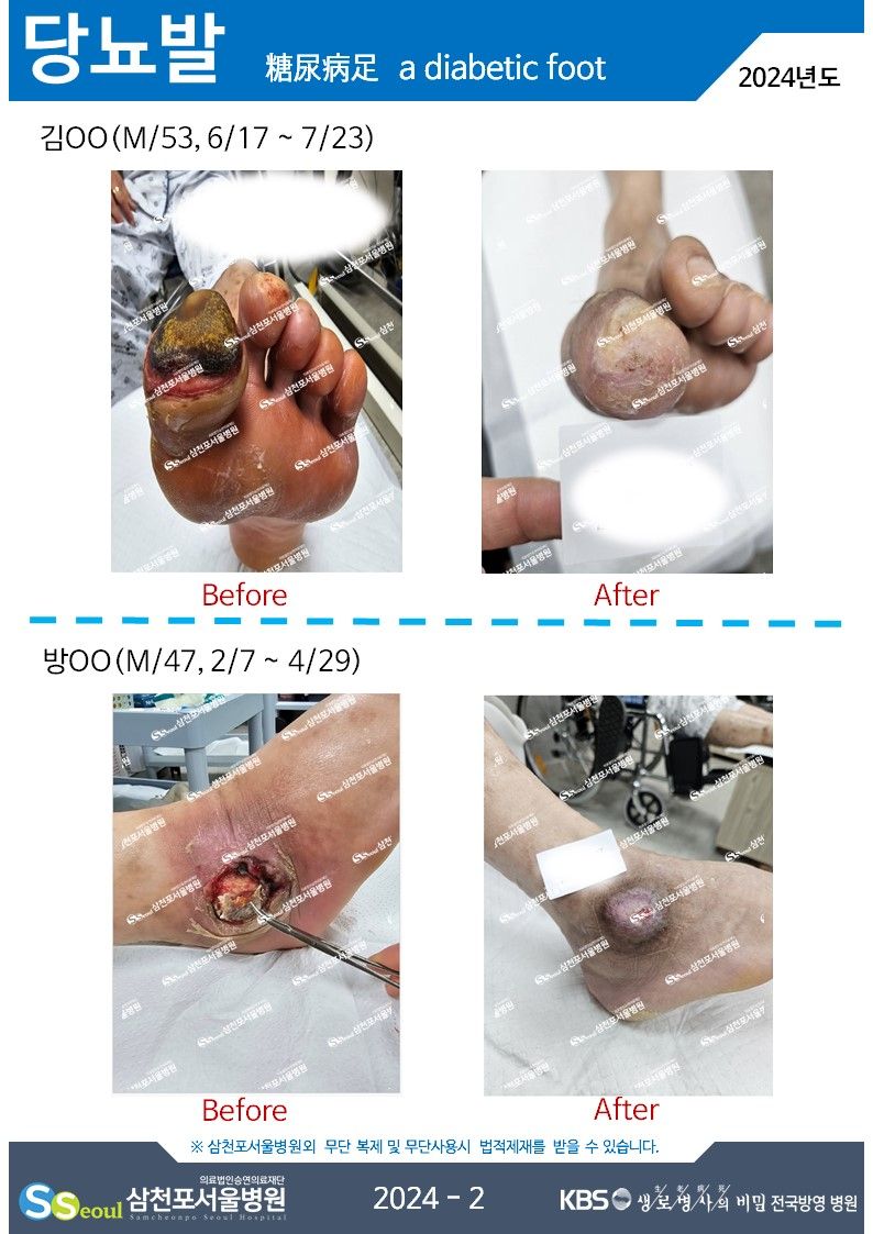 첨부이미지