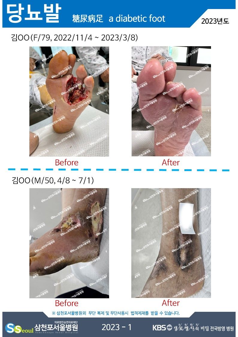 첨부이미지