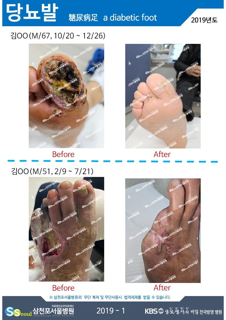 첨부이미지