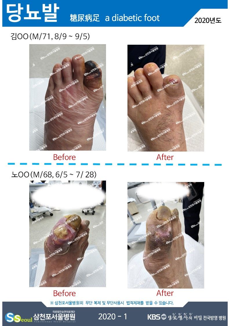 첨부이미지