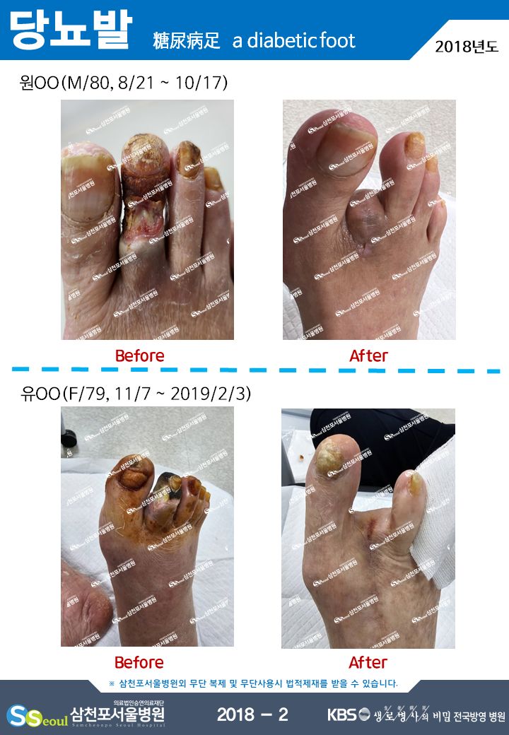 첨부이미지
