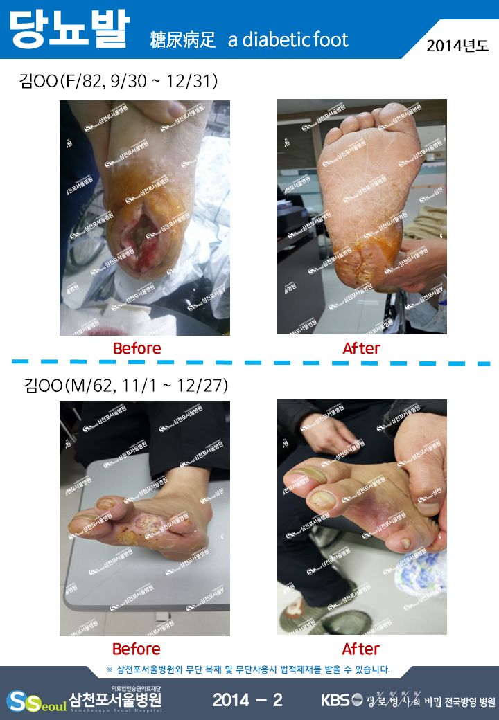 첨부이미지