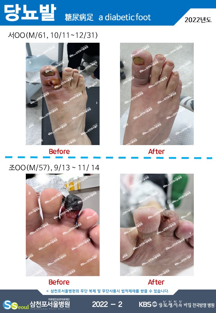 첨부이미지