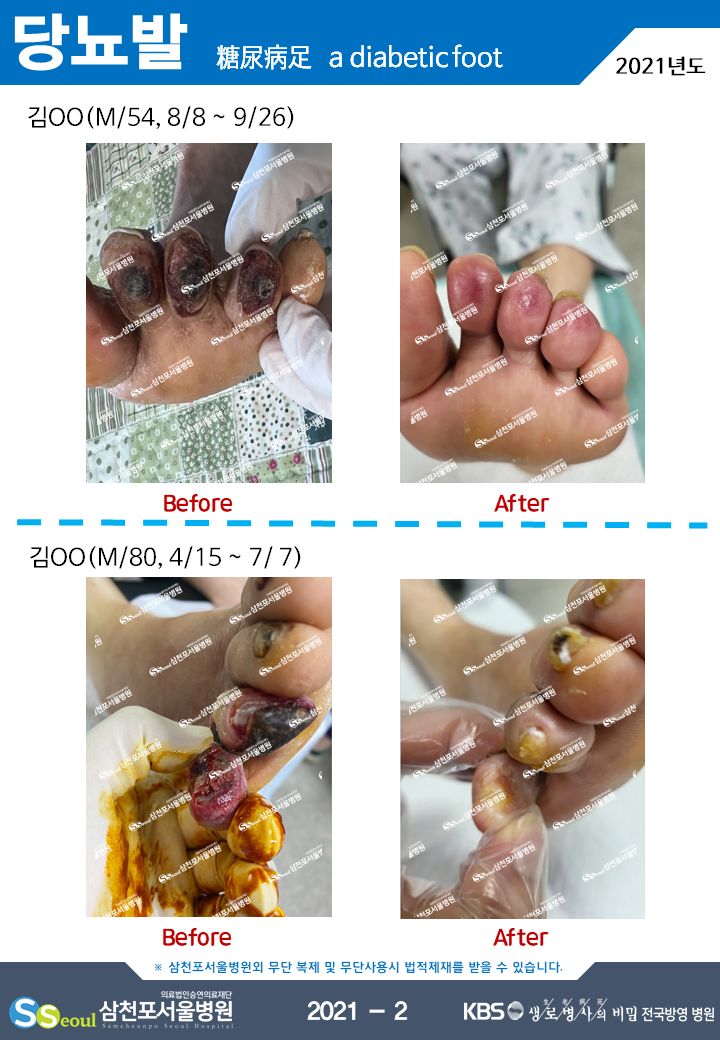 첨부이미지