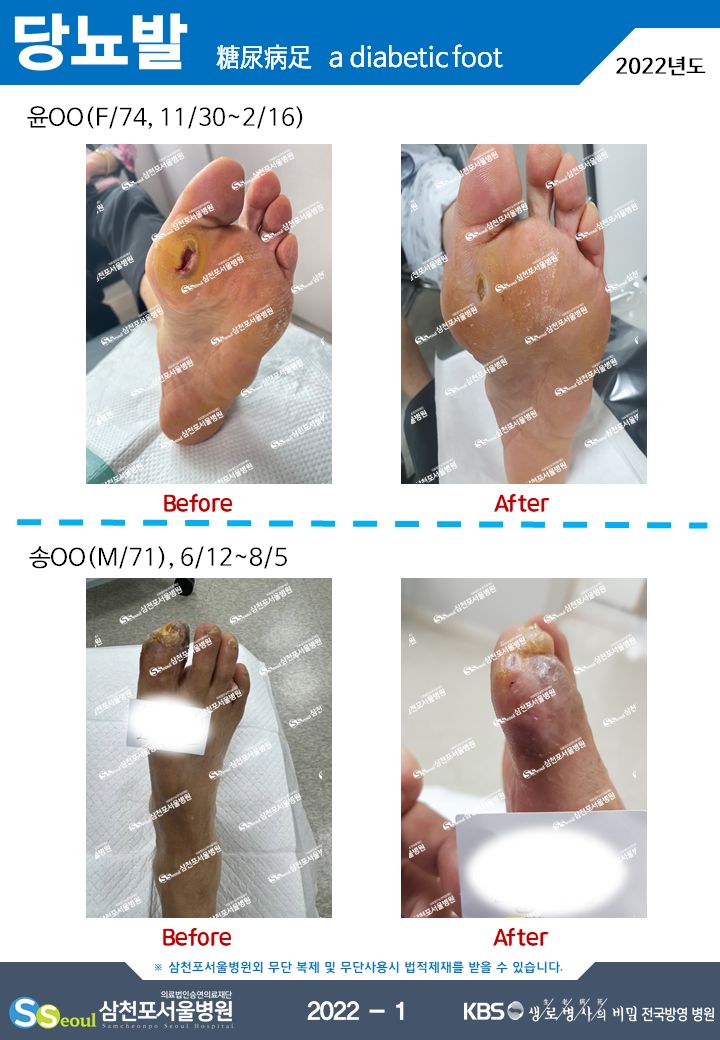 첨부이미지