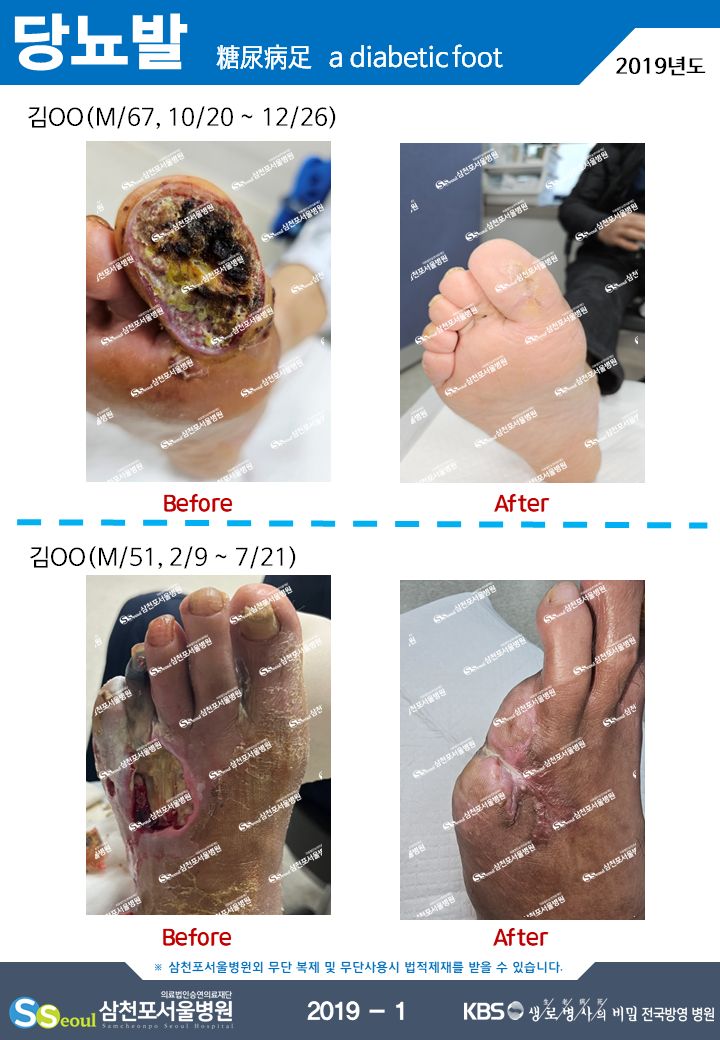 첨부이미지