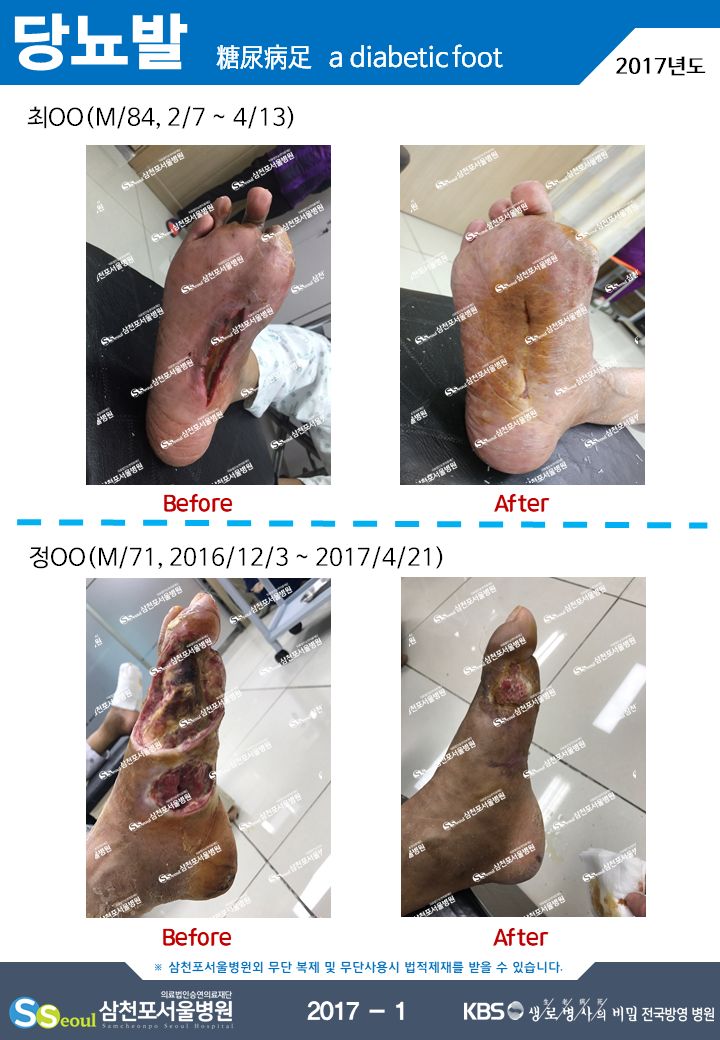 첨부이미지